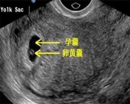 正规供卵中心,北京助孕试管价格？