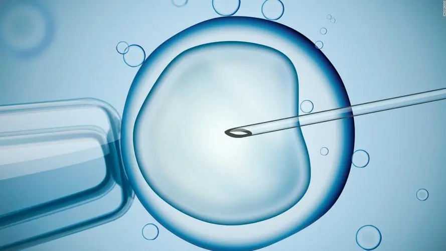 福州地下助孕微信 福州900医院三代试管婴儿费用明细 ‘双胞胎孕囊怎么看男女